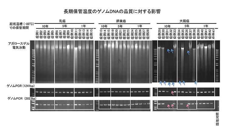 長期保管温度のゲノムDNAの品質に対する影響