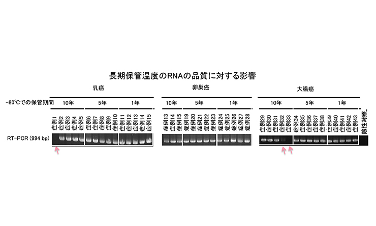 長期保管温度のRNAの品質に対する影響