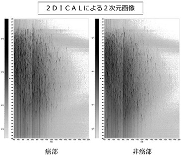 ２ＤＩＣＡＬによる２次元画像