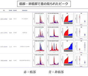 癌部・非癌部で差の見られたピーク