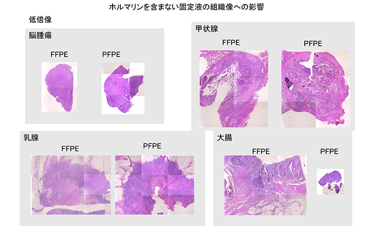 ホルマリンを含まない固定液の組織像への影響（低倍率）