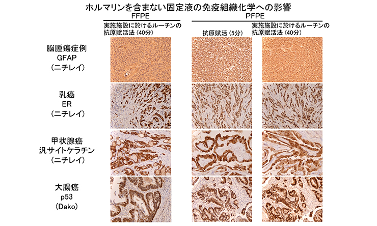 ホルマリンを含まない固定液の免疫組織化学への影響