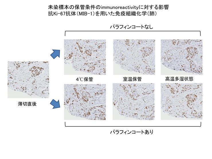 未染標本の保管条件のimmunoreactivityに対する影響　抗Ki-67 抗体（MIB-1）を用いた免疫組織化学（肺）