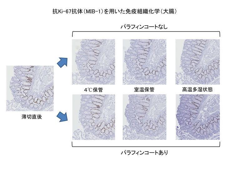 抗Ki-67 抗体（MIB-1）を用いた免疫組織化学（大腸）