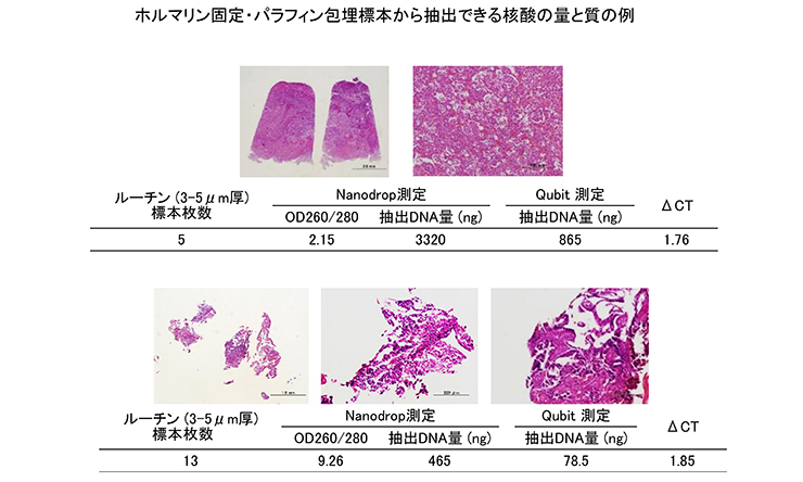 ホルマリン固定・パラフィン包埋標本かた抽出できる核酸の量と質の例（１）