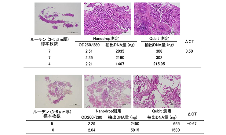 ホルマリン固定・パラフィン包埋標本かた抽出できる核酸の量と質の例（3）